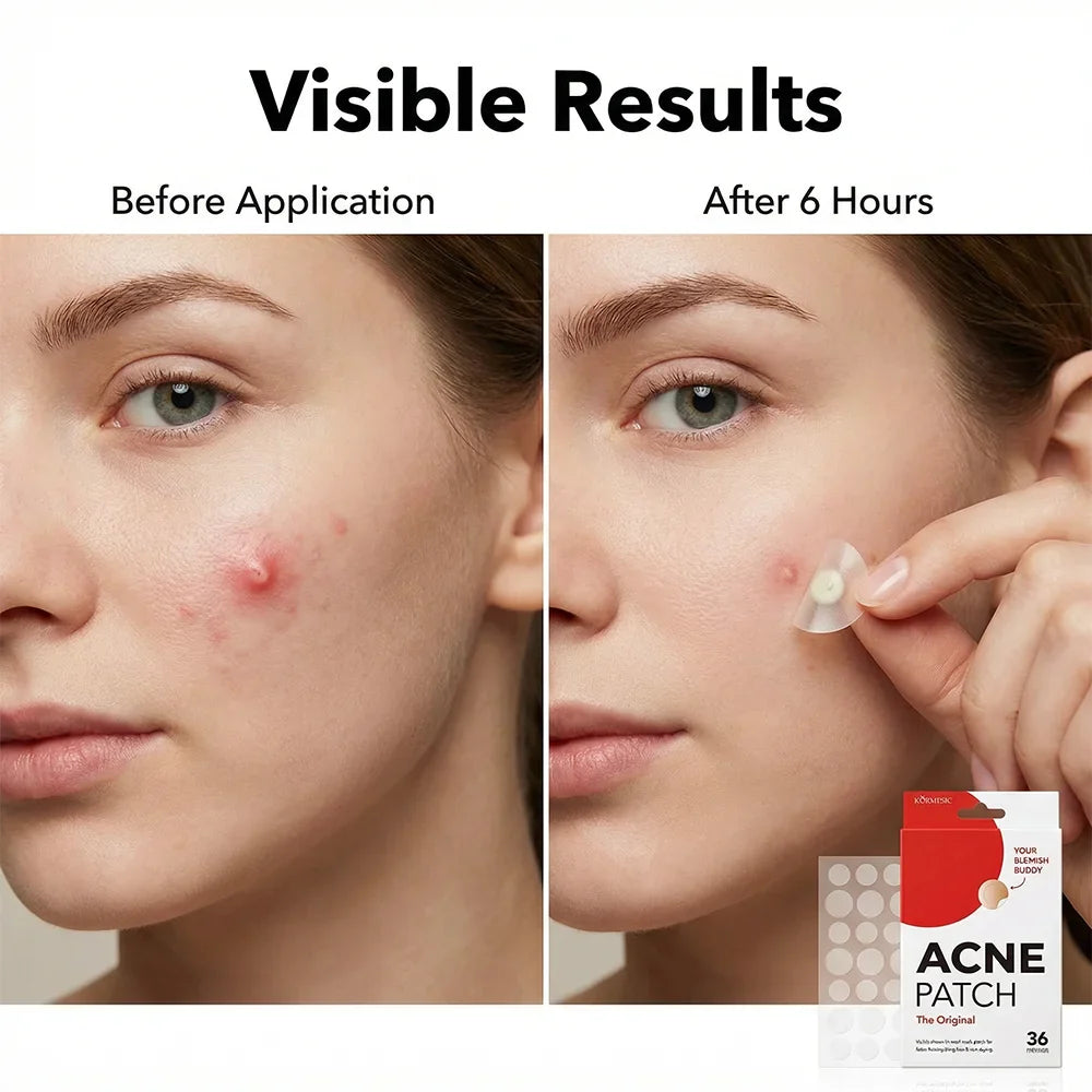 Invisible Pimple Patches